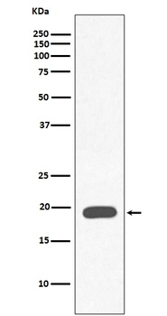 Myoglobin MB Rabbit Monoclonal Antibody