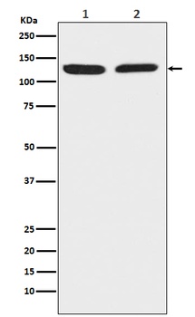 Anti-Chromogranin B CHGB Monoclonal Antibody