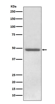 ADFP PLIN2 Rabbit Monoclonal Antibody
