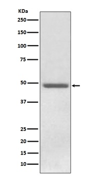 Anti-ADFP PLIN2 Rabbit Monoclonal Antibody