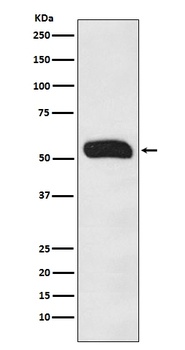 Human IgG IGHG1 Rabbit Monoclonal Antibody