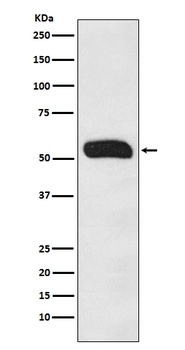 Anti-Human IgG IGHG1 Rabbit Monoclonal Antibody