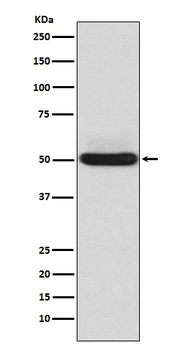 alpha Sarcoglycan Rabbit Monoclonal Antibody