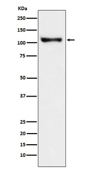 PSD93 Monoclonal Antibody