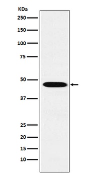 Anti-Wnt2b Monoclonal Antibody