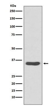 Anti-CDCA5/Sororin Rabbit Monoclonal Antibody