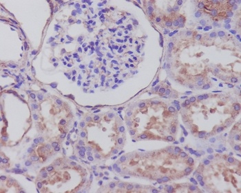 Anti-Synaptophysin SYP Rabbit Monoclonal Antibody