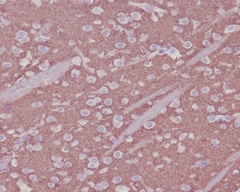 Anti-Synaptophysin SYP Rabbit Monoclonal Antibody