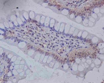 Anti-Musashi 1 MSI1 Rabbit Monoclonal Antibody