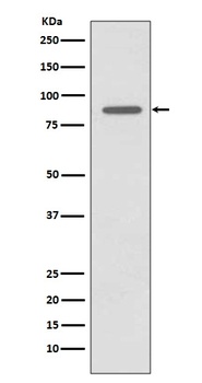 CD168 HMMR Rabbit Monoclonal Antibody