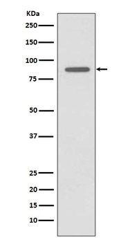 Anti-CD168 HMMR Rabbit Monoclonal Antibody