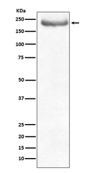 NEFH/Nf H Rabbit Monoclonal Antibody