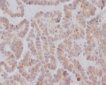 Anti-KIFC1 Rabbit Monoclonal Antibody