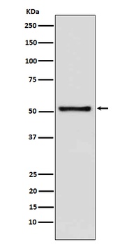 TDT DNTT Monoclonal Antibody