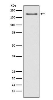 Anti-NSD3/WHSC1L1 Rabbit Monoclonal Antibody