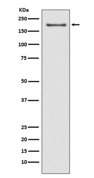 NSD3/WHSC1L1 Rabbit Monoclonal Antibody