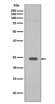 Anti-Rab9 RAB9A Rabbit Monoclonal Antibody