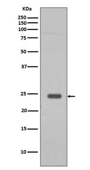 Rab9 RAB9A Rabbit Monoclonal Antibody