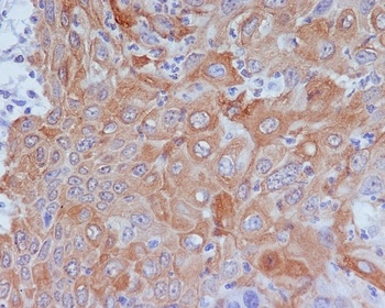 Anti-GM130 GOLGA2 Rabbit Monoclonal Antibody