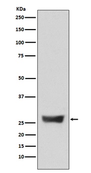 Anti-NDUFS3 Monoclonal Antibody
