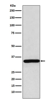 gamma Sarcoglycan Rabbit Monoclonal Antibody