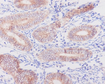 Anti-Flotillin 1 FLOT1 Rabbit Monoclonal Antibody