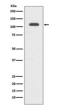 Anti-GART Rabbit Monoclonal Antibody