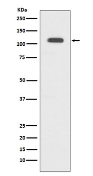 GART Rabbit Monoclonal Antibody