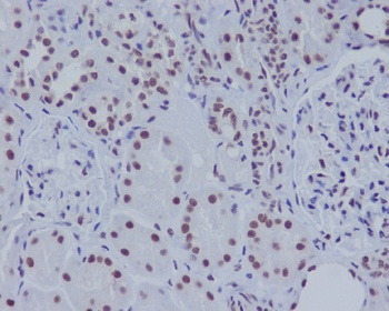 ASH2L Rabbit Monoclonal Antibody