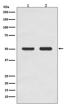 AP2M1/Ap 2 Mu 1 Rabbit Monoclonal Antibody