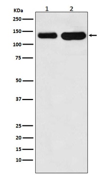 Anti-K-Cadherin-6 CDH6-Monoclonal Antibody
