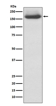 NEFM/Nf M Rabbit Monoclonal Antibody