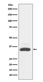 Anti-MAD2L1BP/Mad2L1 Binding Protein Rabbit Monoclonal Antibody