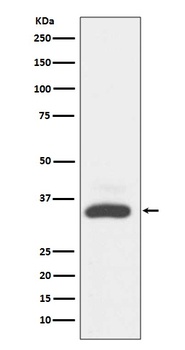 MAD2L1BP/Mad2L1 Binding Protein Rabbit Monoclonal Antibody