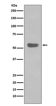 Anti-Cytokeratin 4 KRT4 Rabbit Monoclonal Antibody