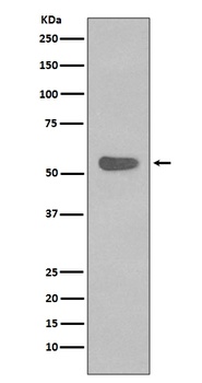 Cytokeratin 4 KRT4 Rabbit Monoclonal Antibody