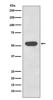 Cytokeratin 4 KRT4 Rabbit Monoclonal Antibody