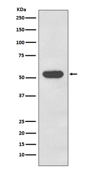 Anti-Cytokeratin 4 KRT4 Rabbit Monoclonal Antibody