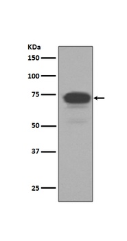5T4 TPBG Rabbit Monoclonal Antibody