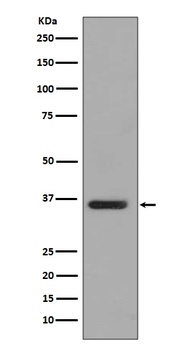 Anti-PP2A alpha + beta Rabbit Monoclonal Antibody