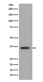 PP2A alpha + beta Rabbit Monoclonal Antibody