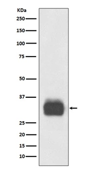 Mast Cell Tryptase Rabbit Monoclonal Antibody