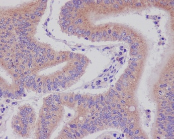 Anti-DNAJC15 Rabbit Monoclonal Antibody