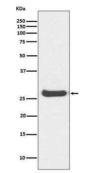 Histone H1.0 H1F0 Rabbit Monoclonal Antibody