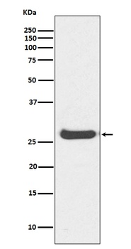 Anti-Histone H1.0 H1F0 Rabbit Monoclonal Antibody