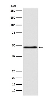 GCET1 SERPINA9 Rabbit Monoclonal Antibody