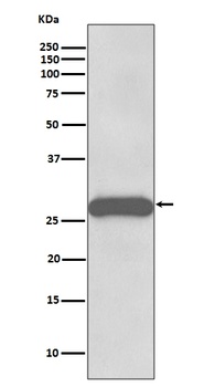 PPP1R1A Rabbit Monoclonal Antibody