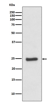 Anti-ZNRF2 Rabbit Monoclonal Antibody