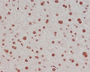 Anti-Methyl-Histone H3 (di K4) HIST1H3A Rabbit Monoclonal Antibody