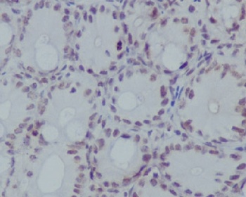 Histone H3 (mono methyl R17) HIST1H3A Rabbit Monoclonal Antibody